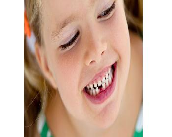 Çocuklarda Diş Sağlığına İlişkin Doğru Bilinen Yanlışlar