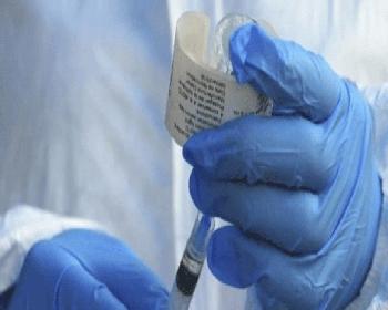 Nijerya’Da “Lassa Sıtması” Alarmı: 42 Ölü